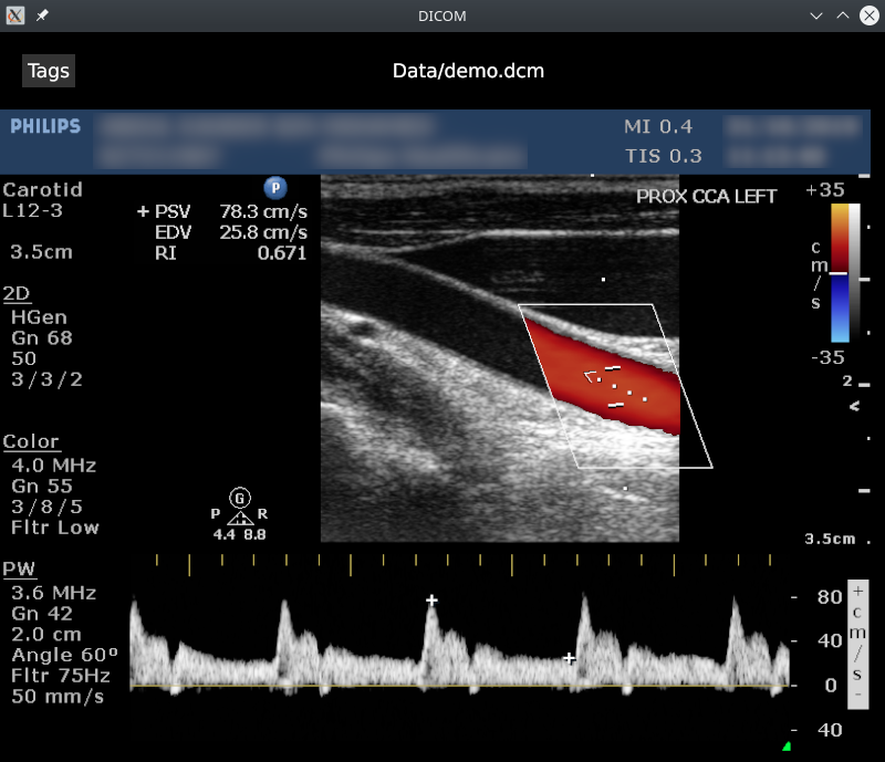 OxyDICOM displaying the US scan image embdedded into the DICOM OxyDICOM screenshot 1