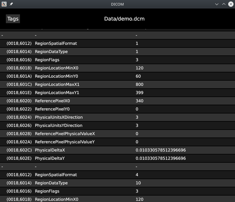 OxyDICOM showing the extracted DICOM tag metadata tree OxyDICOM screenshot 2